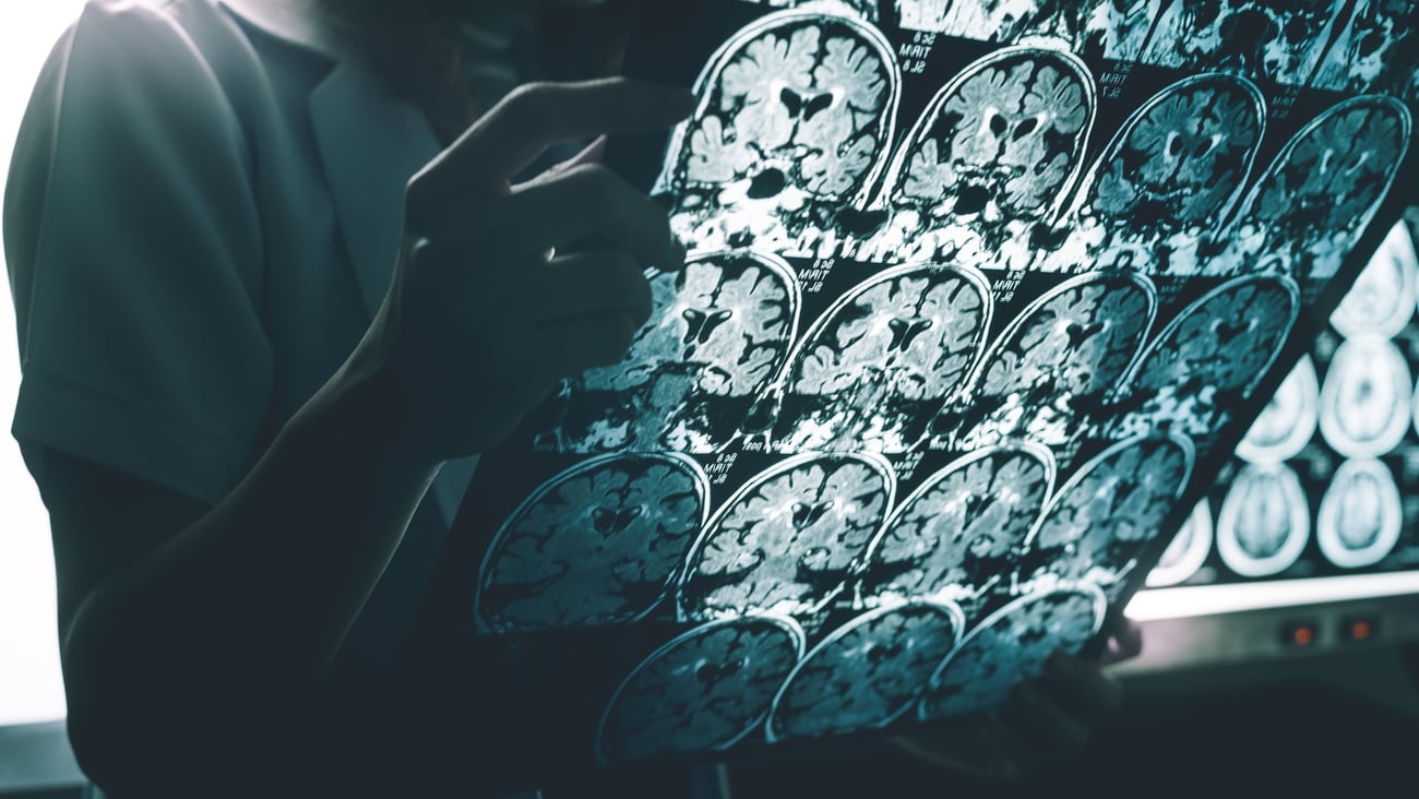 Technician holds x-ray image of brain scans