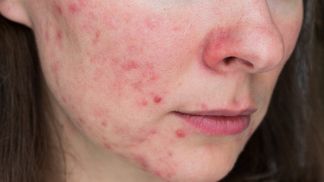 a close up of a person