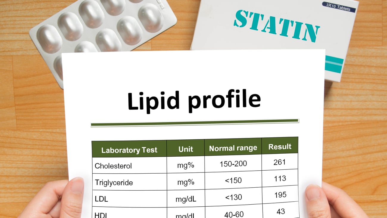 Doctor holing the results of a lipid test