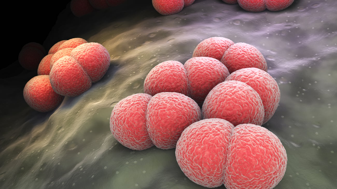 3D image of meningococcal disease