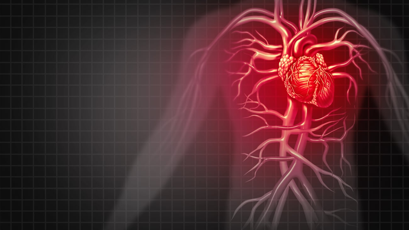 Cartoon of a cardiovascular system