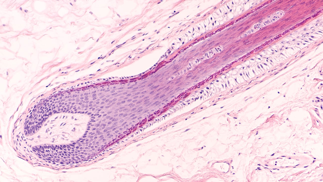 close-up-of-hair-follicle