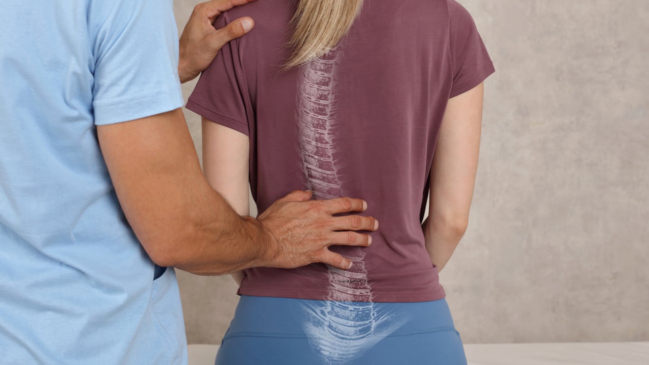 Teen girl having her back examined by a doctor with an illustration of a crooked spine superimposed