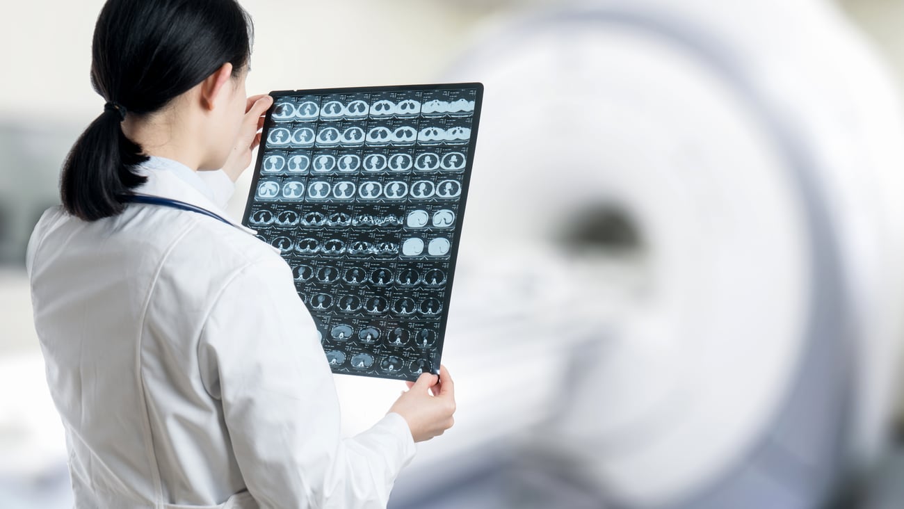 Doctor examines CT imagery of lungs.