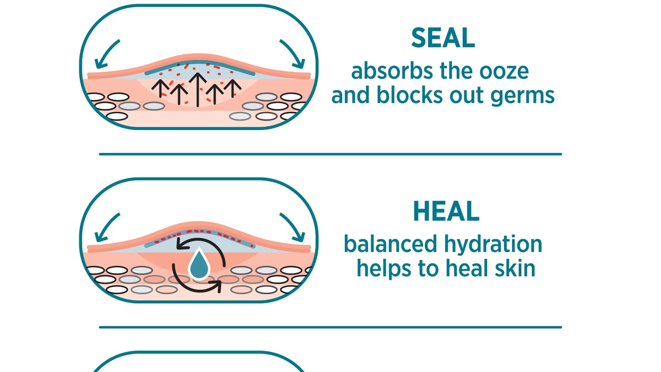 3 steps of advanced healing