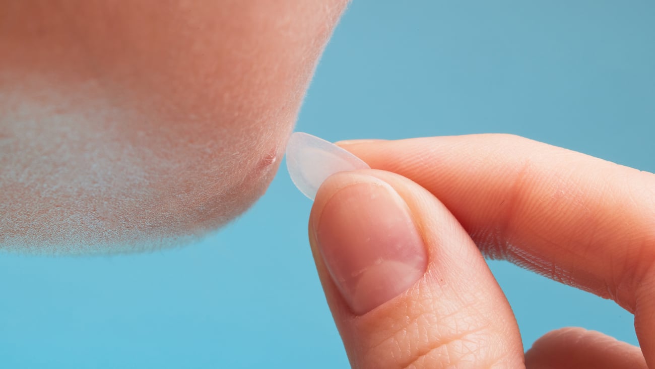 Young person applying a pimple patch to a spot on their face