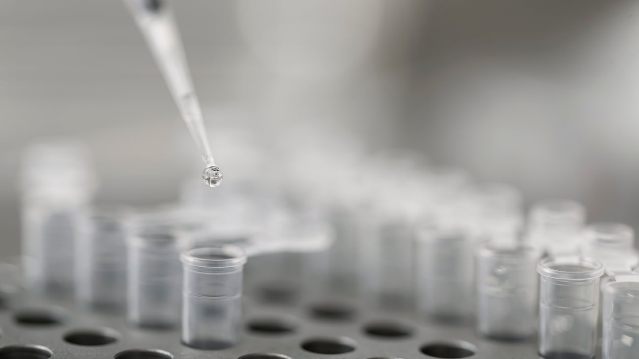 Photo of the PCR test process in the laboratory using special medical equipment. 