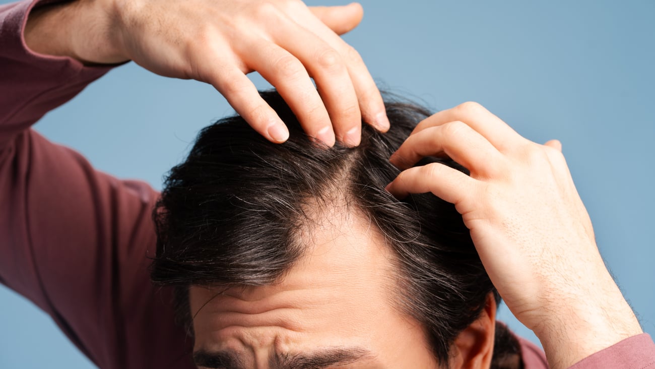 Man looking worriedly at his hairline
