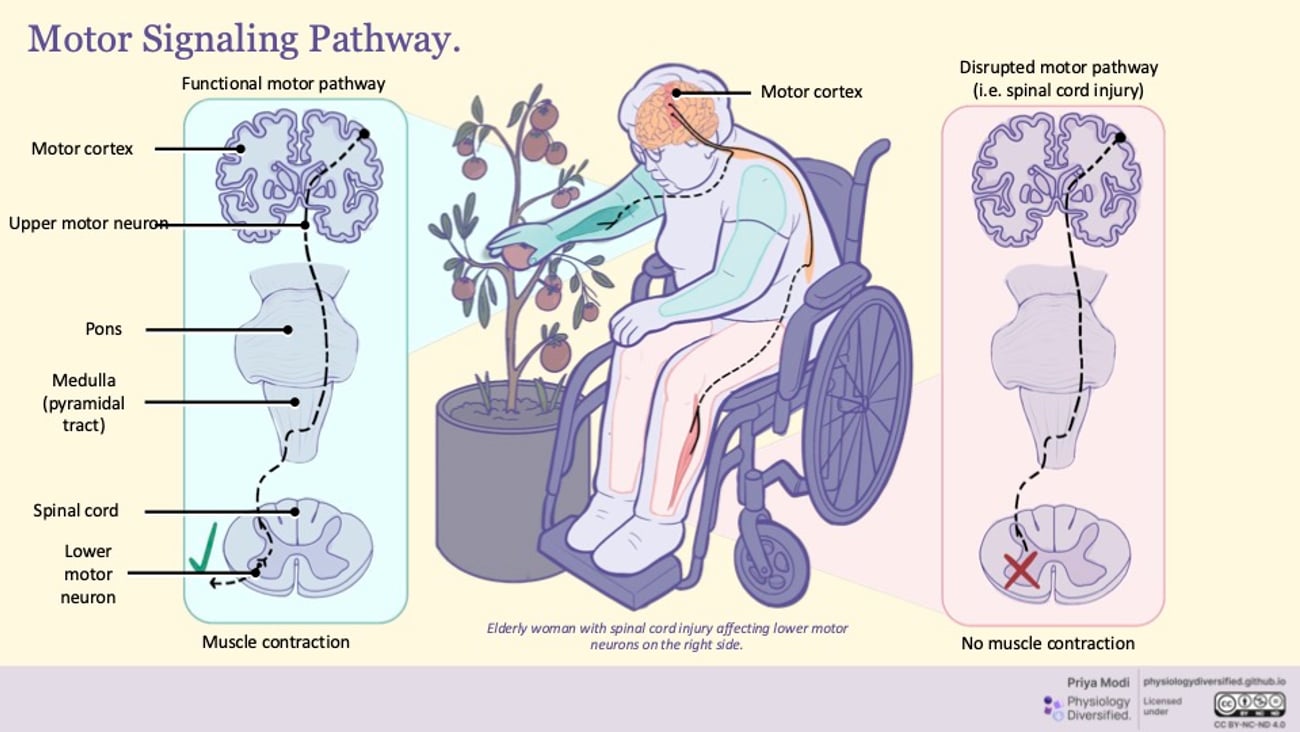 Illustration of elderly woman in a wheelchair picking an apple from a small tree in a pot. Credit Priya Modi