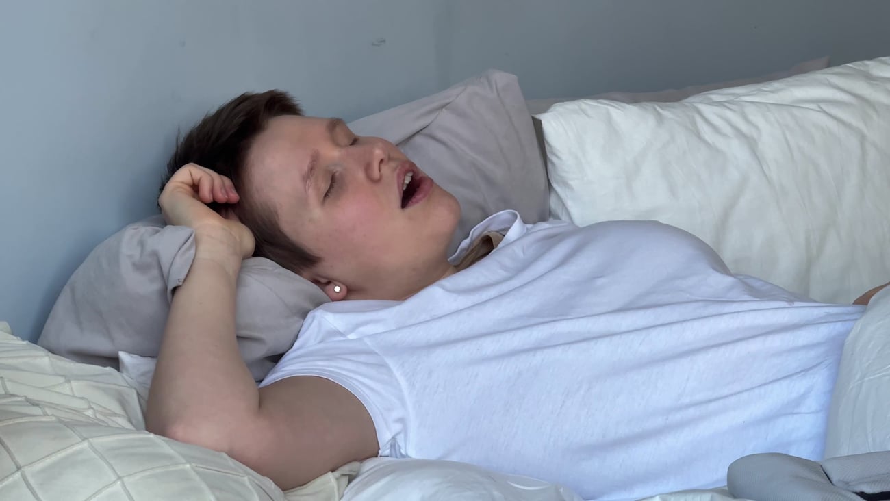 Young woman with apnea, snoring, lying in bed with eyes closed, mouth open