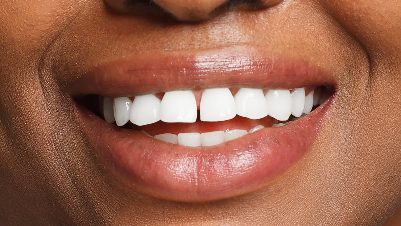 Close up of a dark-skinned woman with a wide happy smile