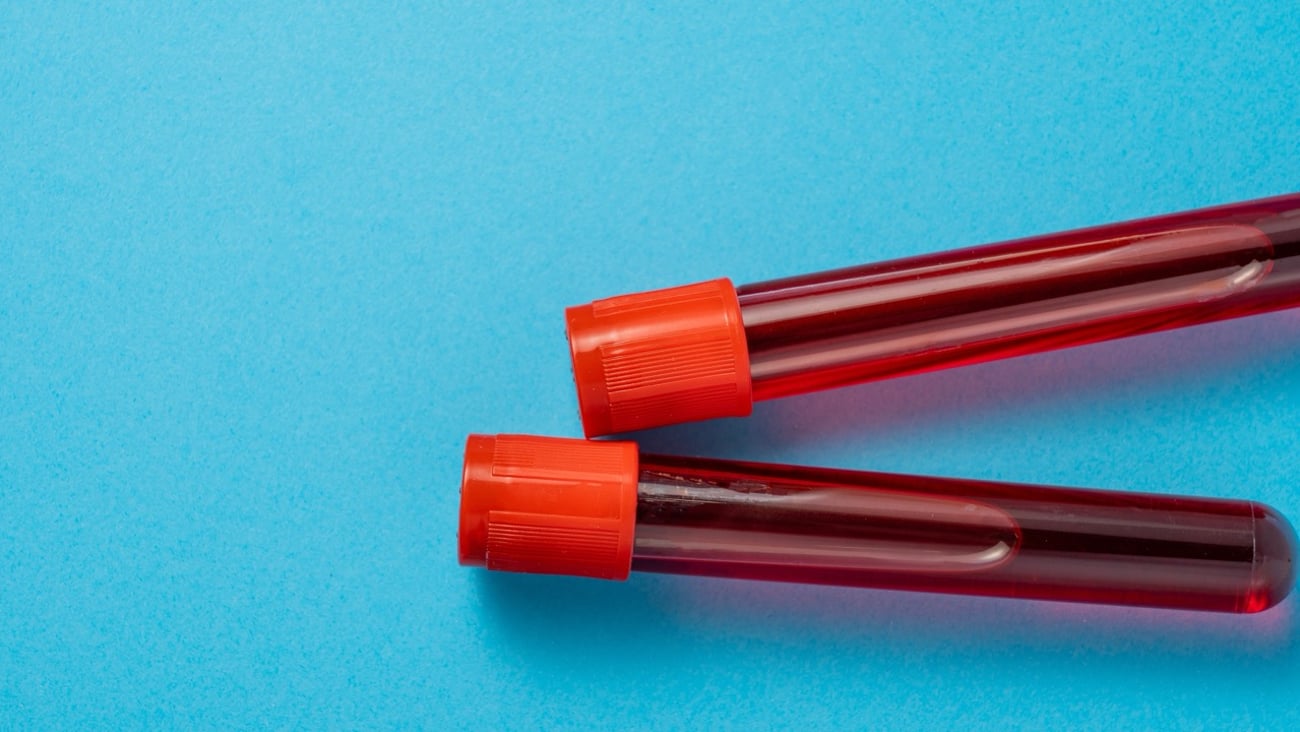 Two vials of blood on a blue background. 