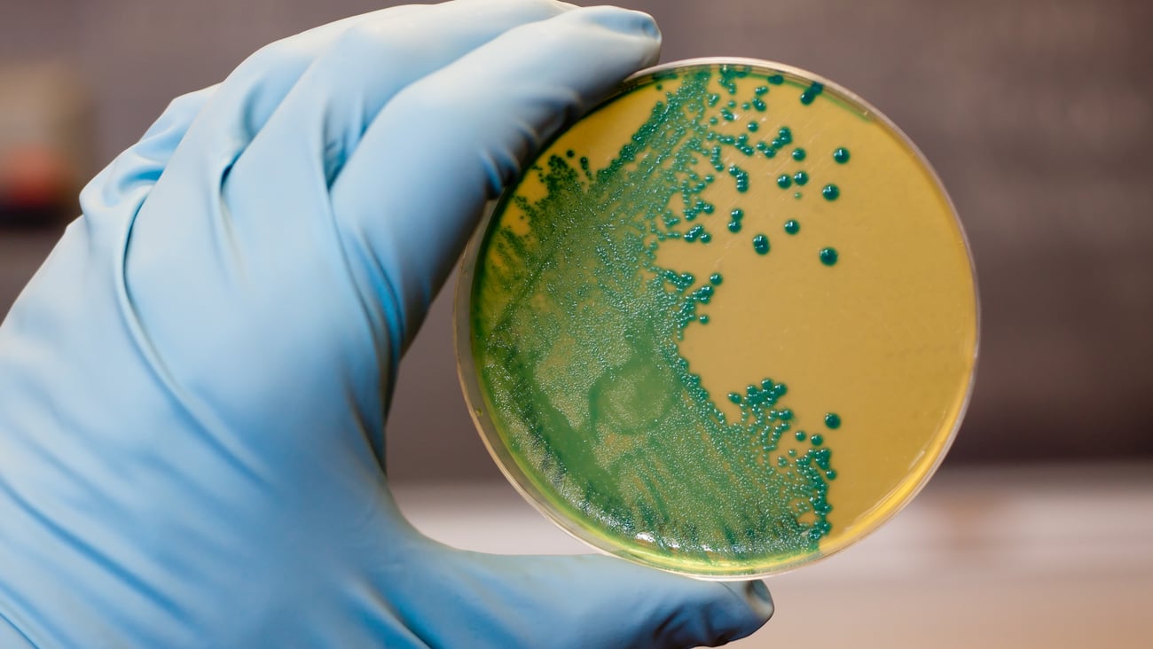 Listeria bacteria culture in a petri dish 