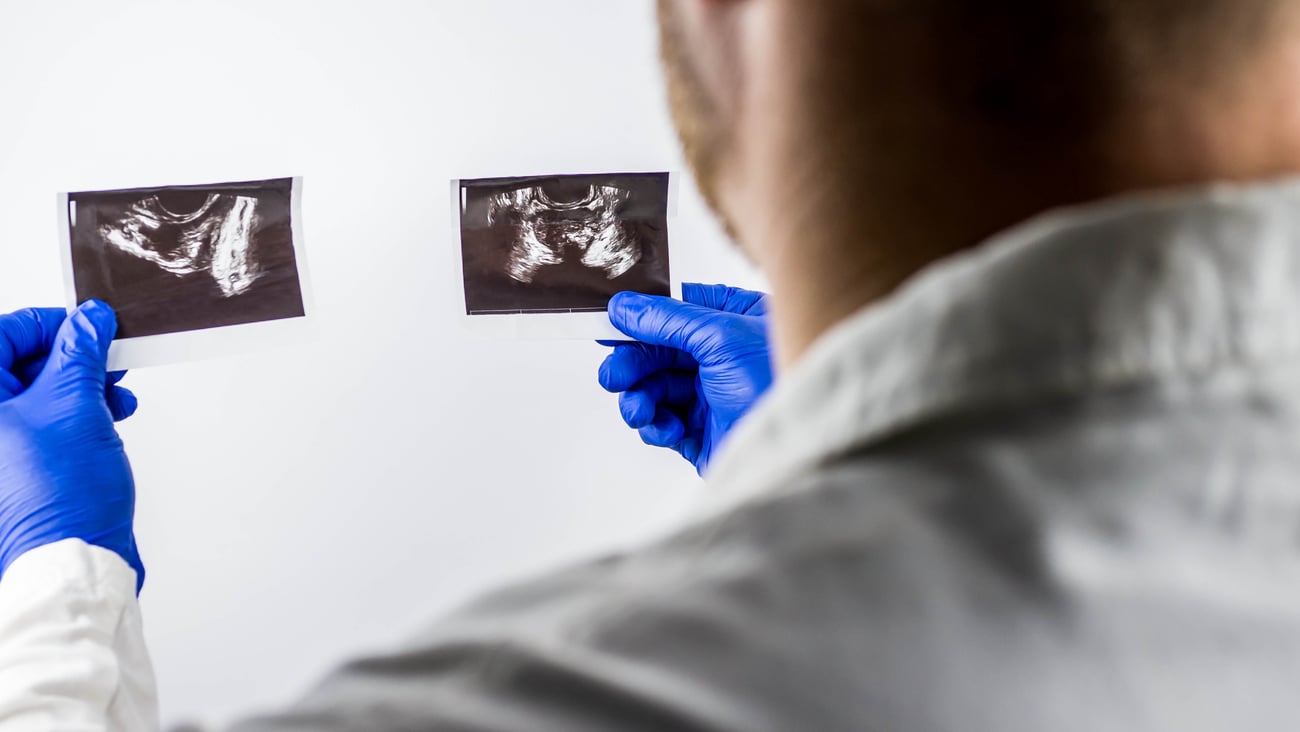 A doctor holds x-ray images of a prostate.