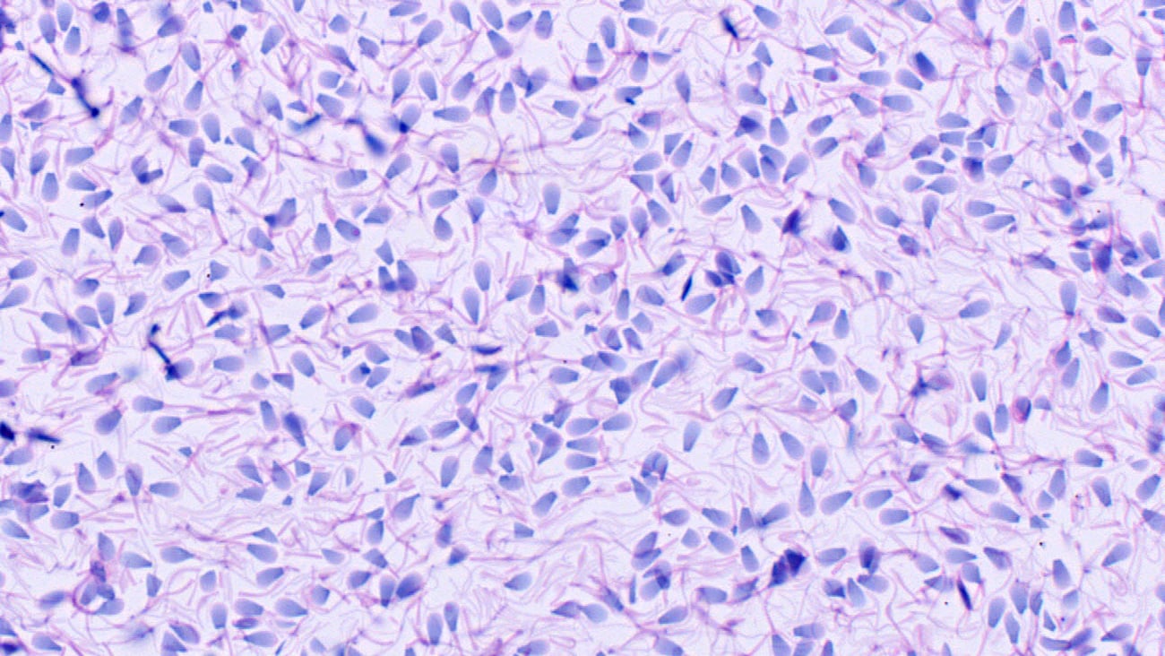 spermatozoa under a microscope
