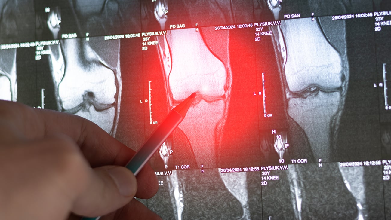 A knee x-ray with one image highlighted in red
