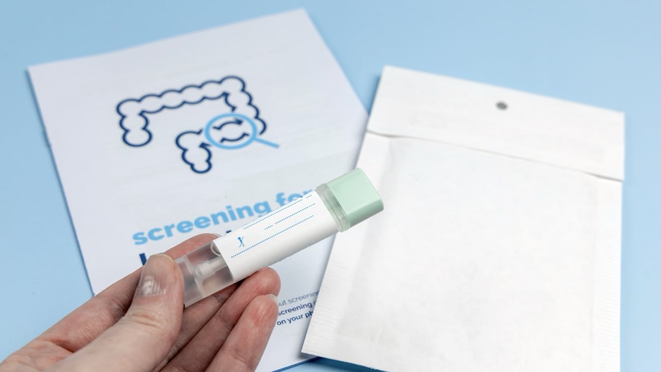 Rectal cancer screening test for home use and lab delivery.