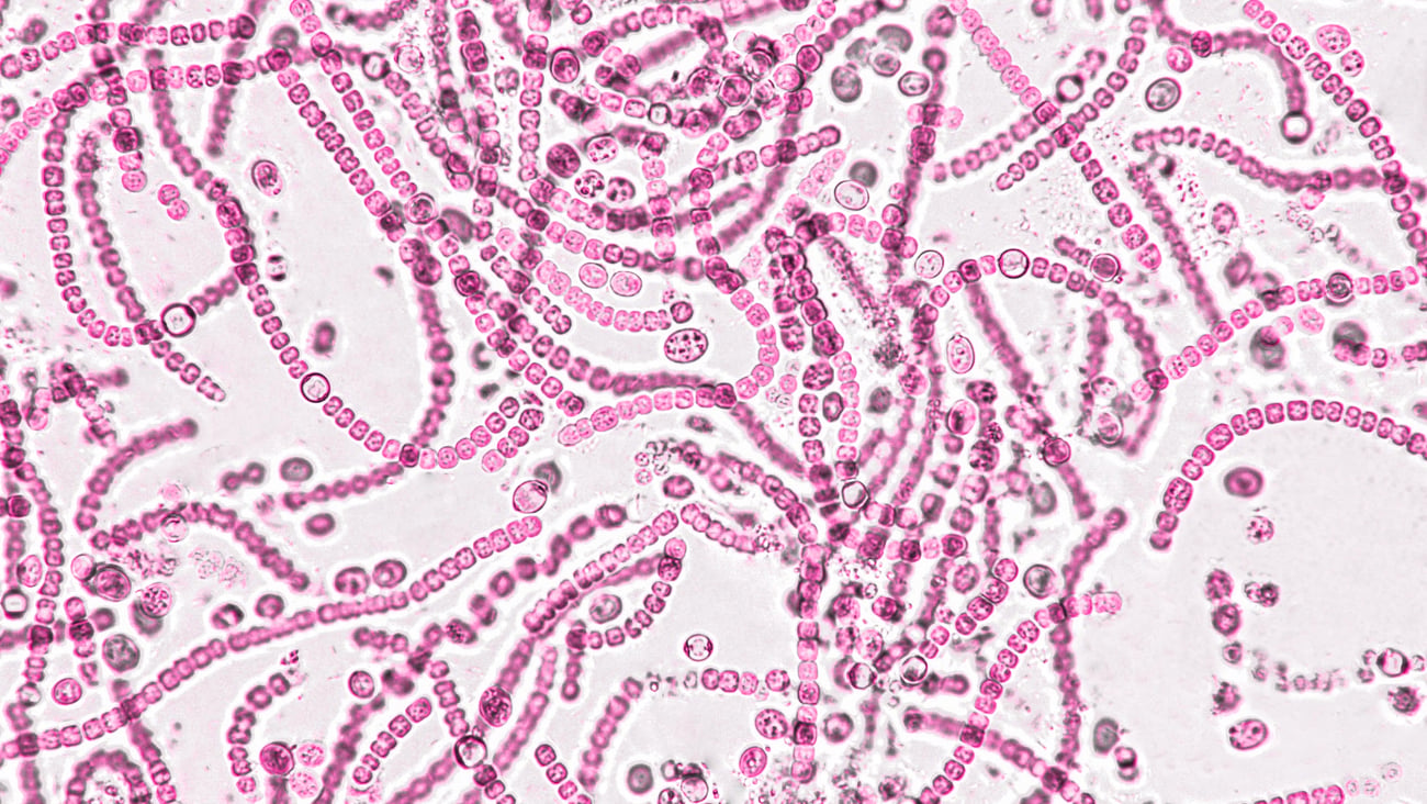 A close up of microbes under a microscope