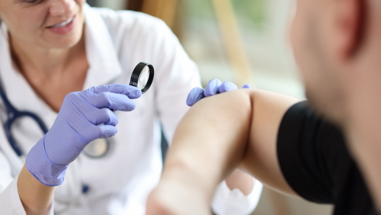 A dermatologist inspects a patient's arm with a magnifying glass.