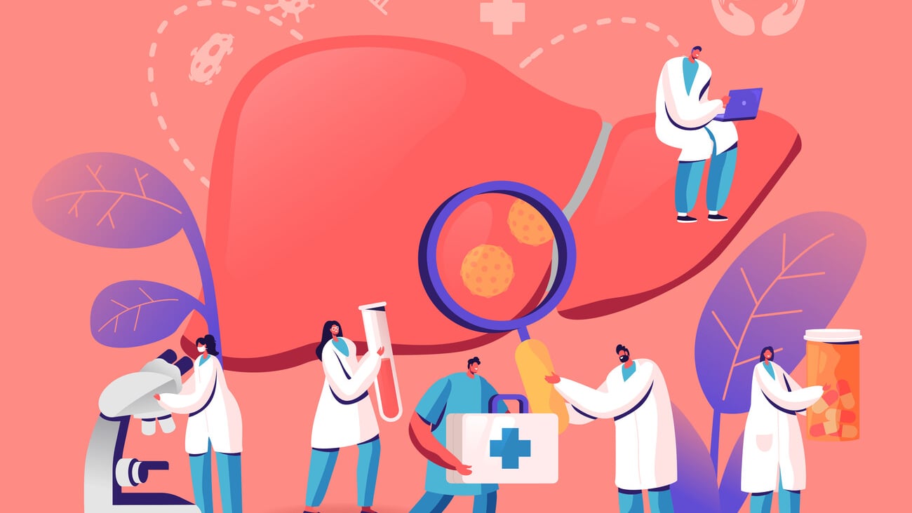 Medical Diagnosis, Hepatitis A, B, C, D World Day, Cirrhosis Concept, Tiny Doctors Taking Care of Patient Diseased Liver, Health Care, Cancer Awareness, Treatment. Cartoon Flat Vector Illustration; Shutterstock ID 1657423456