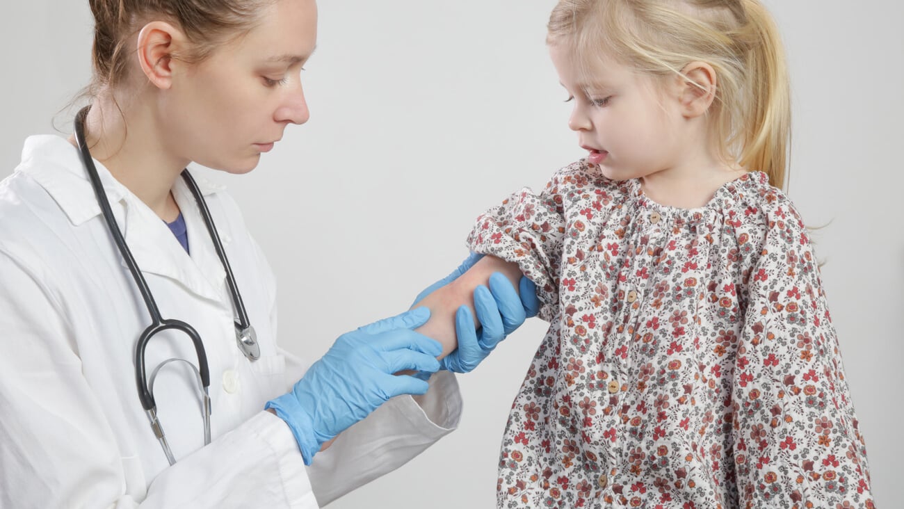 Doctor looking at red and itchy eczema on little girl's arm. Toddler girl suffering from atopic dermatitis.; Shutterstock ID 1941469303