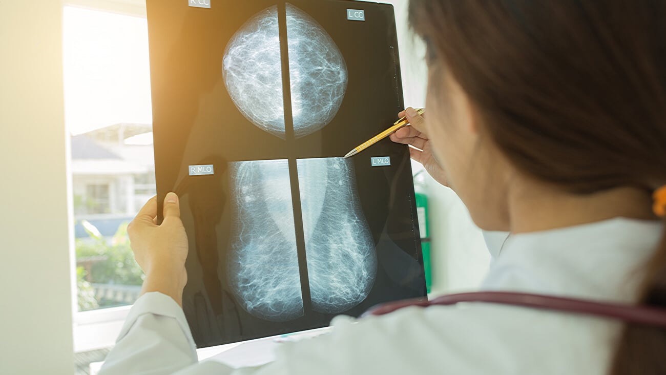 Selective focus Thoughtful female doctor looking at the Mammogram film image.; Shutterstock ID 489104887