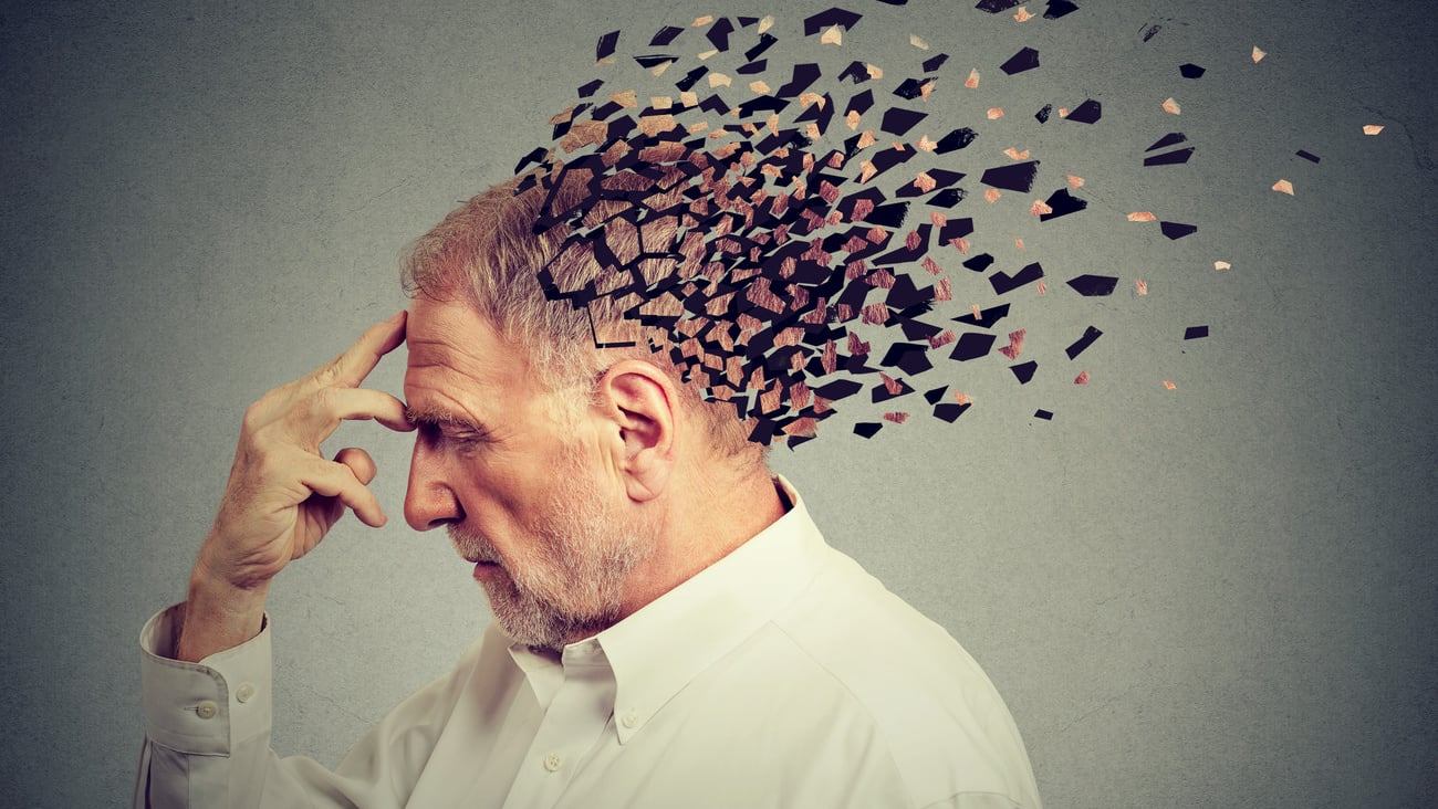 Memory loss due to dementia. Senior man losing parts of head  as symbol of decreased mind function.; Shutterstock ID 754295458