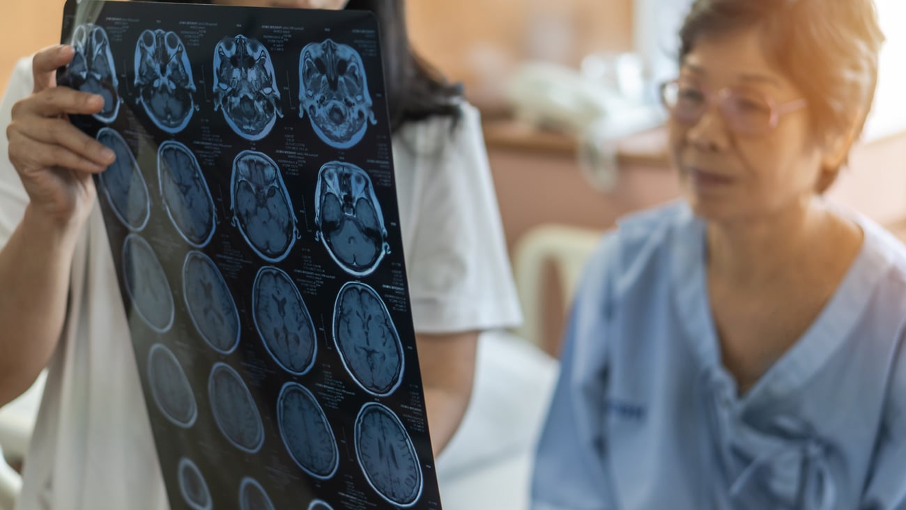 Older woman looking at a scan of her brain with a doctor explaining