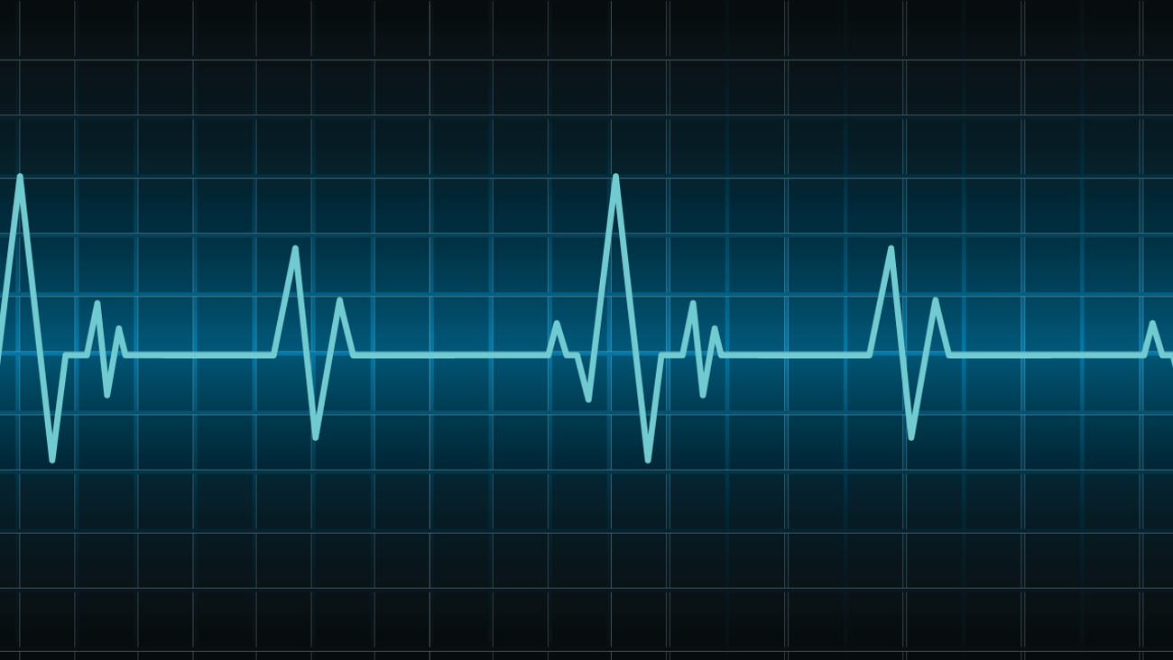 Heartbeat monitor data