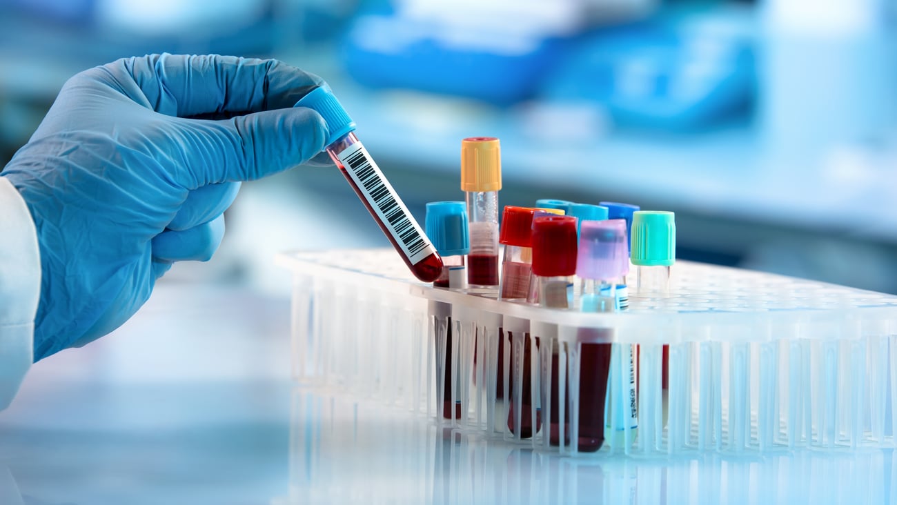 Blue gloved hand holding a vial of blood in a lab for bloodwork