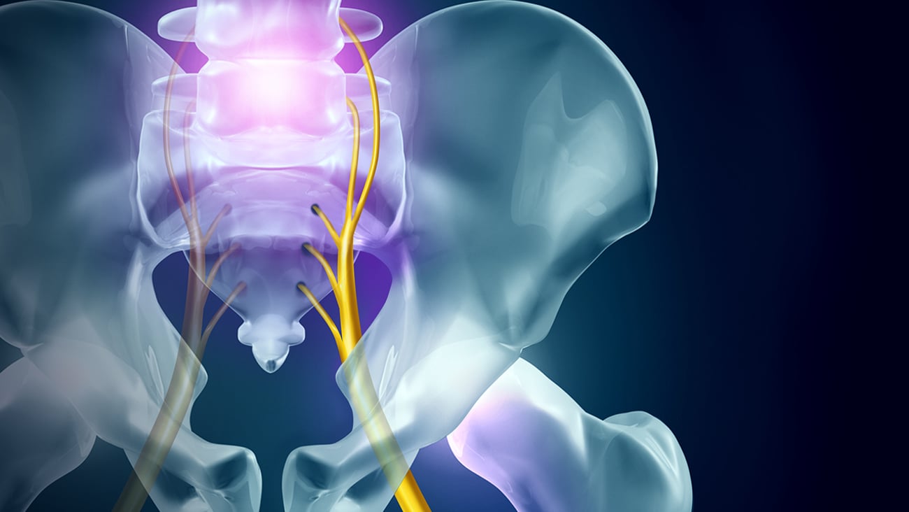 Close up of a human pelvic bone with the sciatic nerve highlighted in purple