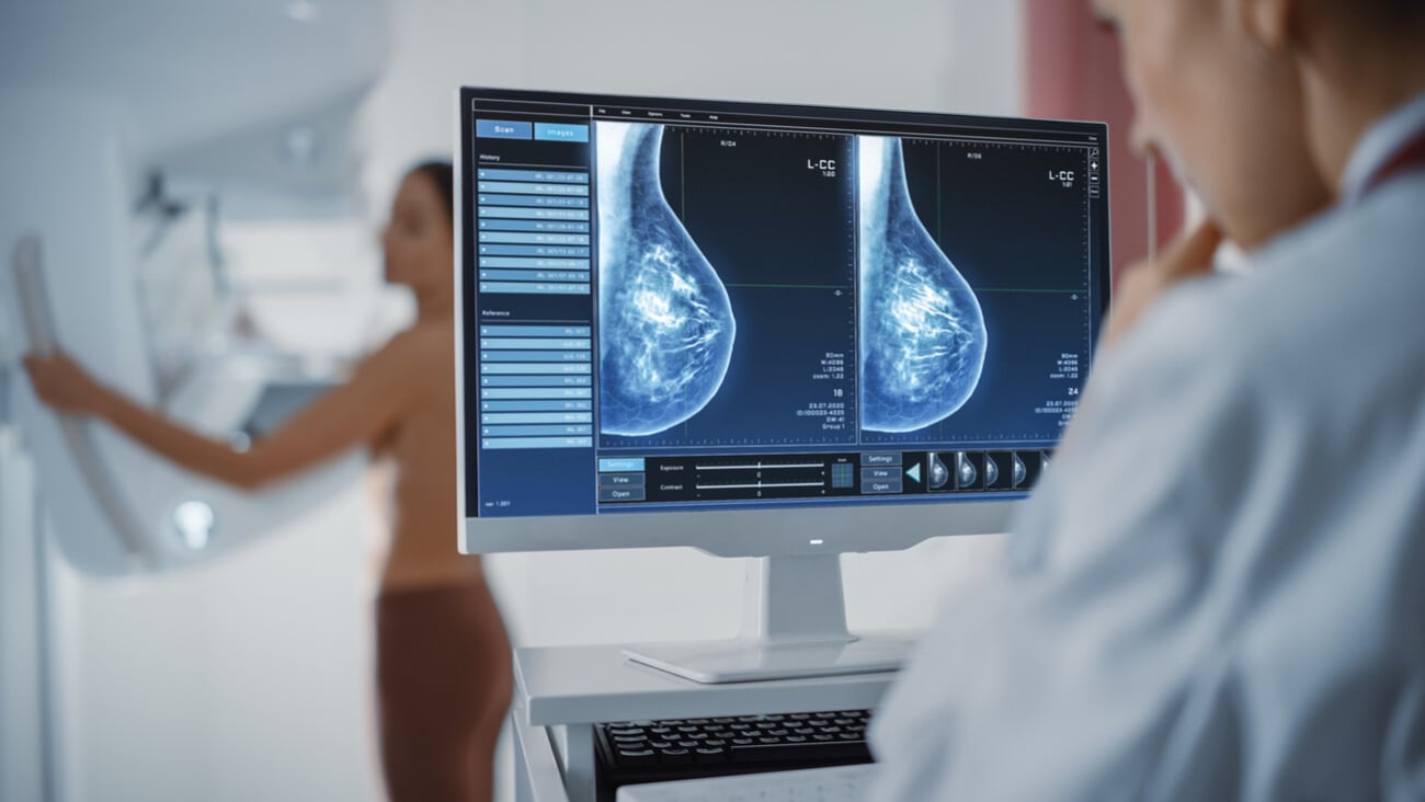 Computer Screen in Hospital Radiology Room: Beautiful Multiethnic Adult Woman Standing Topless Undergoing Mammography Screening Procedure. Screen Showing the Mammogram Scans of Dense Breast Tissues.; Shutterstock ID 1942278202