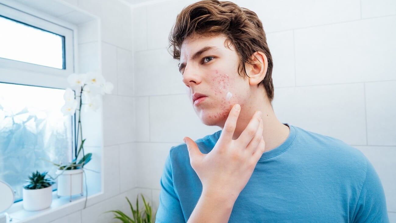 Concentrated caucasian teenage boy with acne problem take care his face skin at home. He looking in the mirror and aplying cream on the face in bathroom. Teenager skin care every day treatment process; Shutterstock ID 2278571303