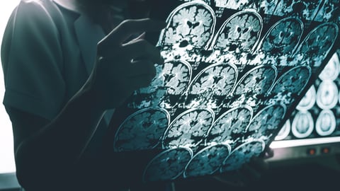 Technician holds x-ray image of brain scans