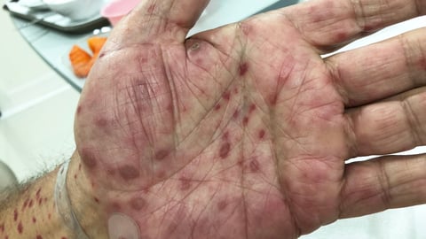a close up of a hand
