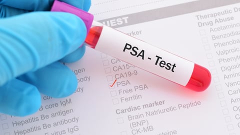 Vial with "PSA test" on it