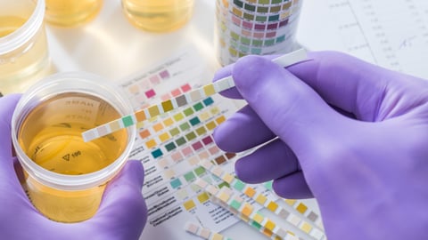 urinalysis-test