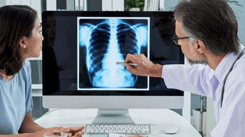 chest xray teaser