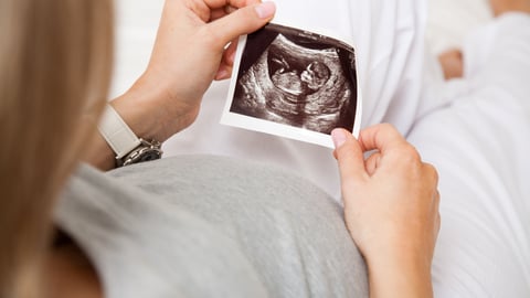 Woman looking at picture of an ultrasound