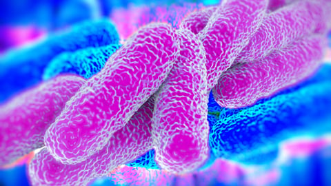 Legionnaires' disease up close