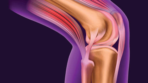 See through medical view of a knee and the inner muscles and bones of the leg