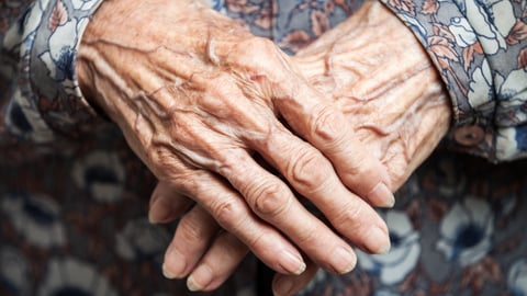 a close up of a hand