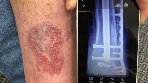 Case report: metal rash