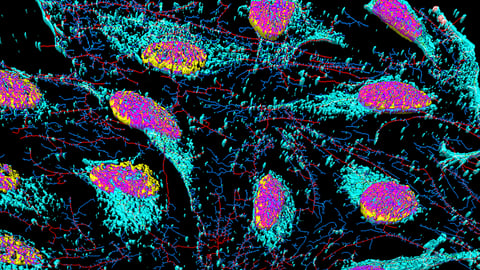 Nuclei, microfilaments and membrane particles in HeLa cells.