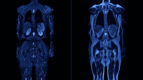 Blue MRI images of two bodies, one shown from front and one from back, both from head to knees,  revealing internal organs