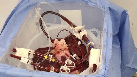 genetically modified pig liver 