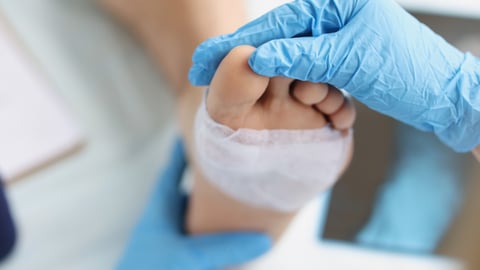 A doctor bandages a foot.