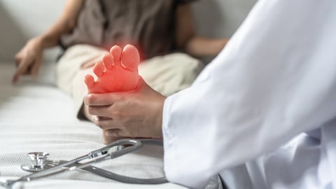 peripheral neuropathy in a patient's foot