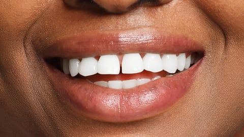 Close up of a dark-skinned woman with a wide happy smile