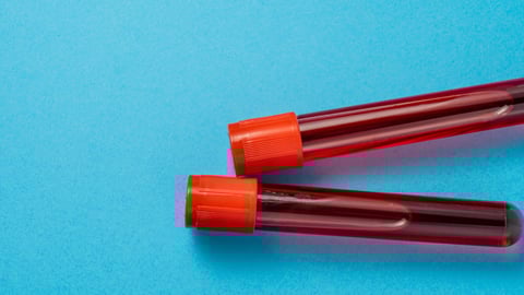 Two vials of blood on a blue background. 